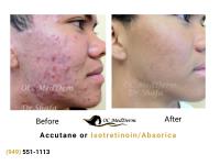 OC MedDerm | Irvine Skin image 4